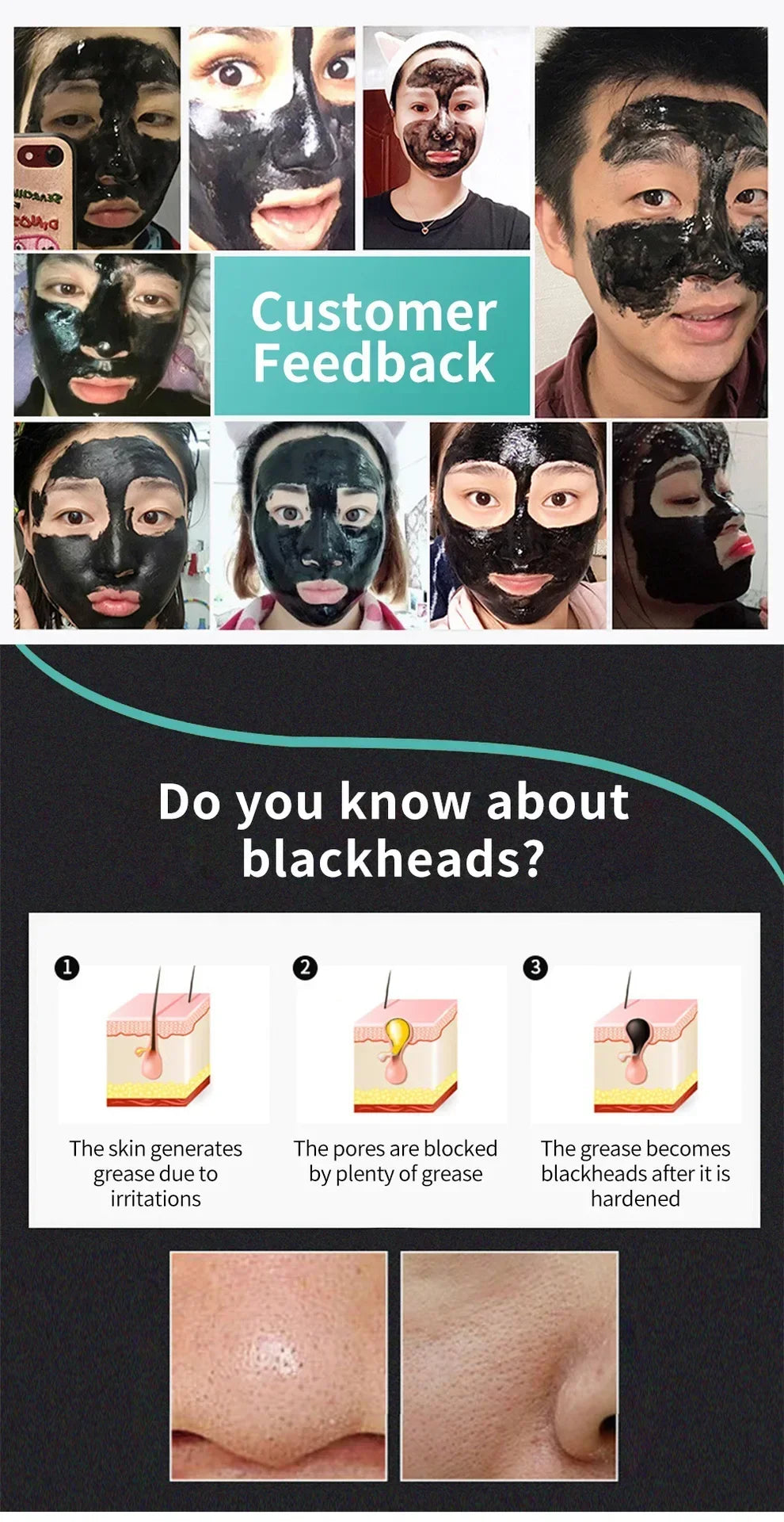 LANBENA Remove Blackhead Mask