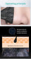 LANBENA Remove Blackhead Mask
